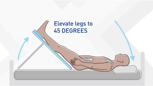 How to Conduct a Passive Leg Raise